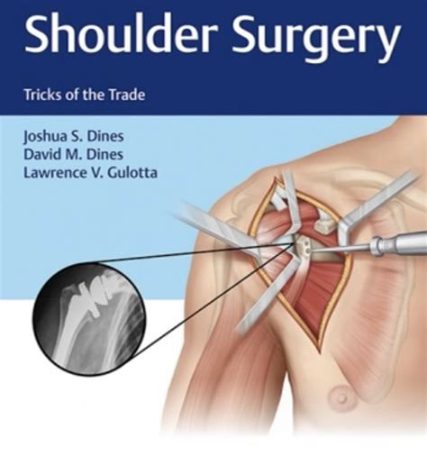 Do You Need Shoulder Surgery Core Omaha Explains C O R E