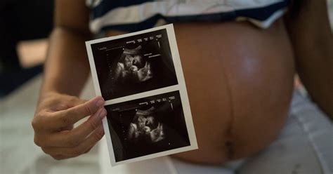 Growing Support Among Experts For Zika Advice To Delay Pregnancy The