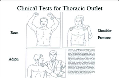 Clinical Tests For Thoracic Outlet Download Scientific Diagram