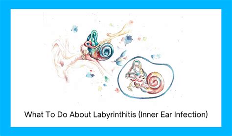 Labyrinthitis And What To Do About It Symptoms Anxiety Stress