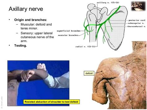 Applied Anatomy Axillary Nerve Injury