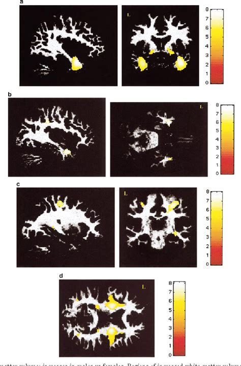 figure 4 from cerebral asymmetry and the effects of sex and handedness on brain structure a