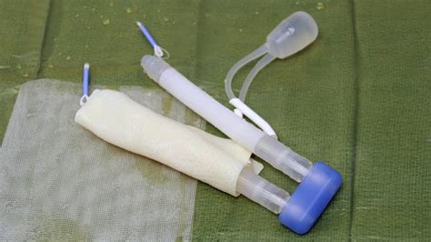 ICS Abstract Inflatable Penile Prosthesis Reimplantation Following Gender Affirming