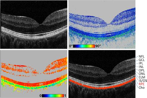 Principles Of Polarization Sensitive Optical Coherence Tomography OCT Download Scientific