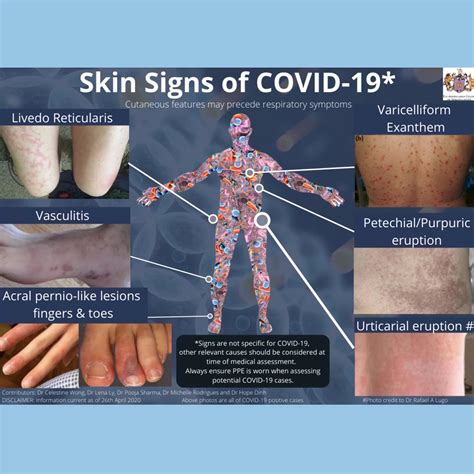 Is Covid 19 Getting Under Your Skin Chroma Dermatology