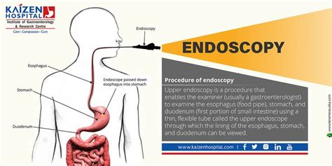 Procedure Of Endoscopy Upper Endoscopy Is A Procedure That Enables The