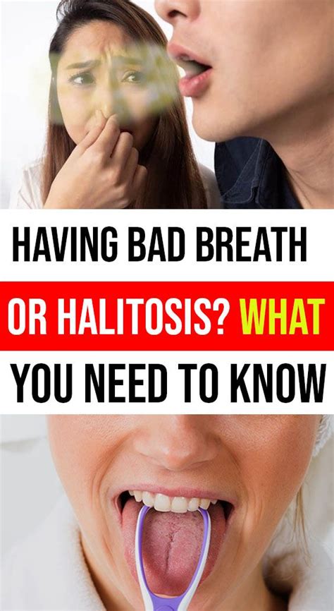 todocare halitosis bad breath medical treatment