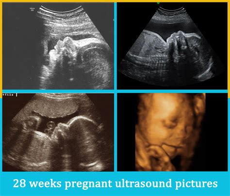 28 Weeks Pregnant Ultrasound