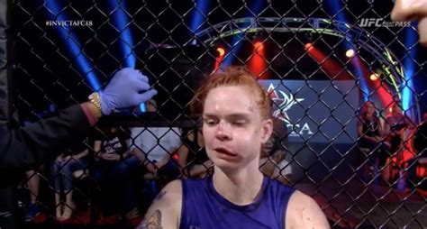 Mma Fighter Loses Fight After Getting The Most Swollen Cheek Youll