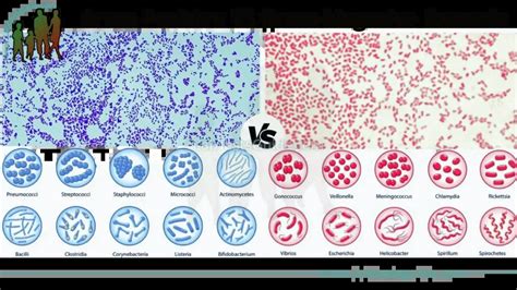 Difference Between Gram Positive And Gram Negative Bacteria Lab Tests