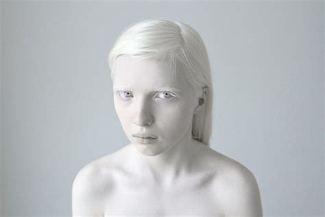 Nude Albino Telegraph