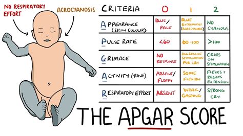 Apgar Score Apgar Score Nursing Mnemonics Emt Study Porn Sex Picture