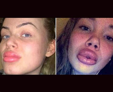 Kylie Jenner Challenge 17 Reasons Why You Should Not Try The