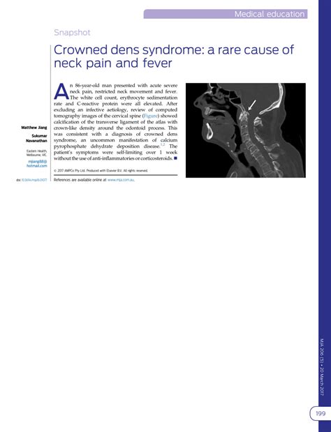 Pdf Crowned Dens Syndrome A Rare Cause Of Neck Pain And Fever