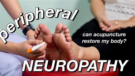 Secrets To Help Your Peripheral Neuropathy Explained By A Doctor
