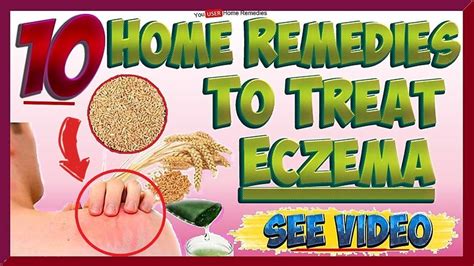 Top 10 Home Remedies And Treatments For Eczema Youtube