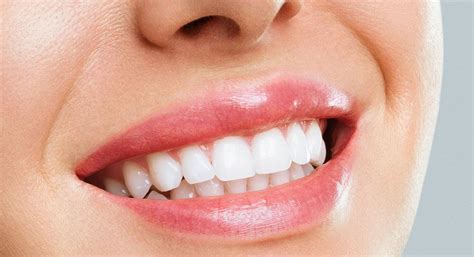 Get Best Smile Makeover Treatment Specialist In Coimbatore