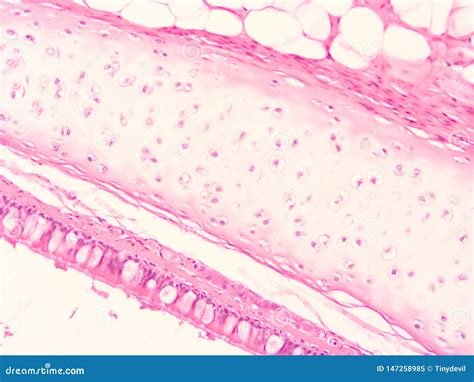 Histology Of Trachea Human Tissue Stock Image Image Of Microscopy