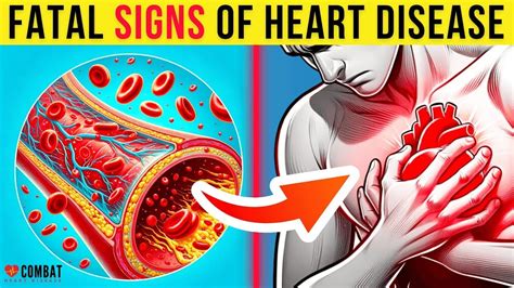 5 Warning Signs That You May Have Heart Disease Youtube