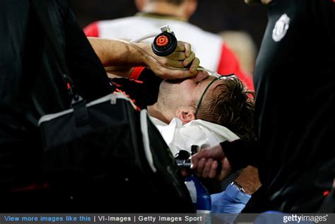 A luke shaw injury will cut his season short. Ouch: Luke Shaw Suffers Horrific Injury 20 Minutes Into Manchester United's Champions League ...