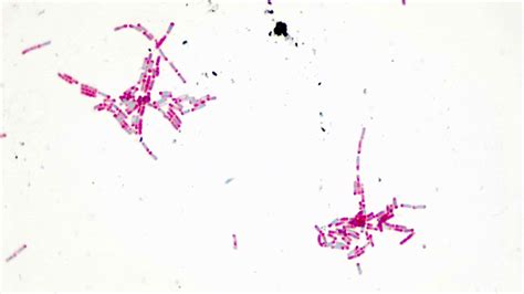 Micrograph Bacillus Cereus H Endospore X P Oer Commons