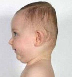 Flat Head Syndrome What It Is And How To Prevent It Moms And Mamas