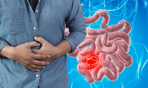 Stomach Pain Bloated It May Signal Bowel Cancer Symptoms And Signs Express Co Uk