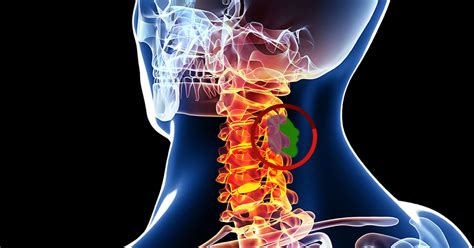 Spinal Tumors Scottsdale Az Orthopedic Spine Surgery