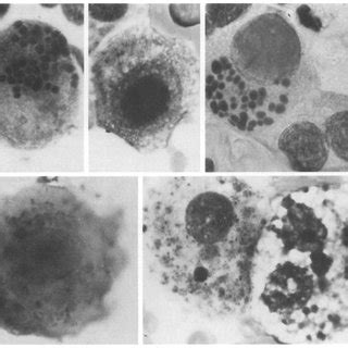 Plant cells have the same structures as animal cells except for chloroplast, cell wall. (PDF) Rapid Cytologic Diagnosis of Cytomegalovirus ...
