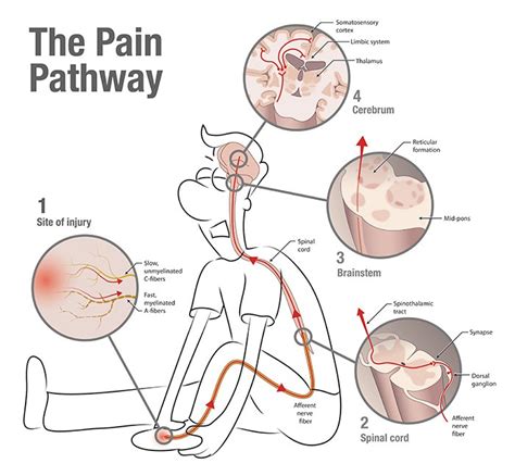 What A Pain — Insight Massage