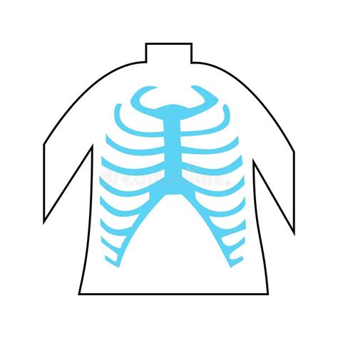 Thoracic trauma may present as an isolated rib fracture, a chest contusion, or a laceration; Lungs And Rib Cage Posterior View Stock Illustration ...