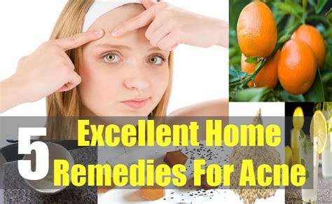 5 Excellent Home Remedies For Acne Natural Home Remedies And Supplements