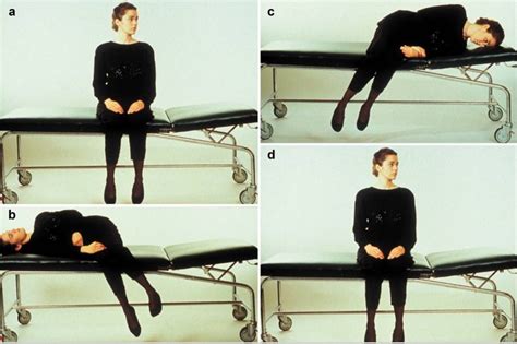 Dix Hallpike Maneuver And Epley Maneuver Indications