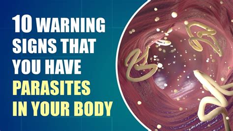 Dont Ignore These Early Symptoms Of Parasites In Your Body Youtube