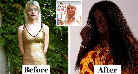 Blonde Air Stewardess Decided To ‘become Black With Tanning Injections