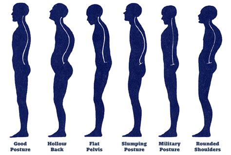 Hass Fitness How To Fix Bad Posture