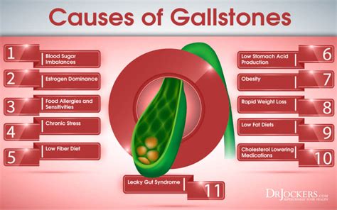 22 Symptoms Of Gallbladder Disease