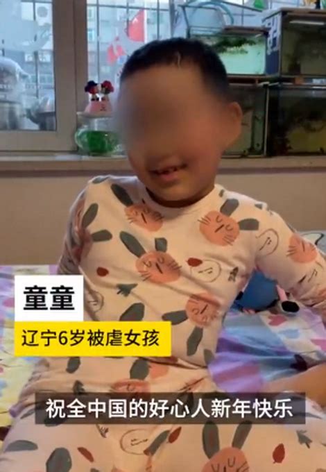 辽宁6岁被虐女童现状恢复良好，头发种植成功，网友：放心了！ 北晚新视觉