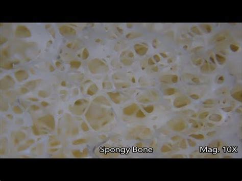 Both types of bone marrow are enriched with blood vessels and capillaries.2. Human Bone Under the Microscope - YouTube | Human bones ...