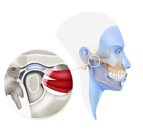 Temporomandibular Joint Oral And Maxillofacial Surgery