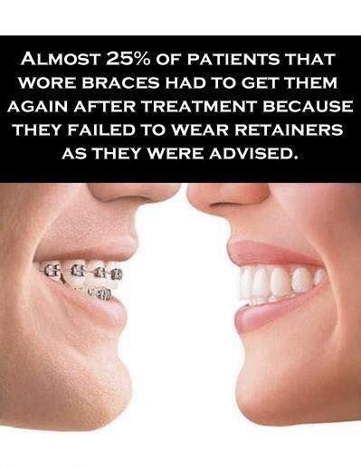 Retainers After Braces Retainers Dental Fun Orthodontics