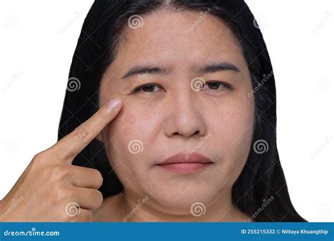 Asian Woman Showing The Flabbiness Of Adipose Sagging Skin Flabby And
