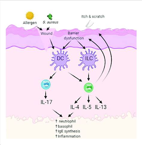 Simplified Schematic Of Pathogenesis Of Atopic Dermatitis Ad With Download Scientific