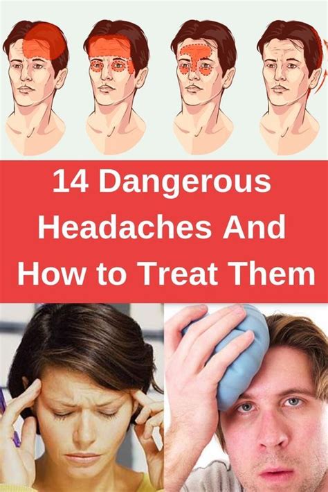 14 Dangerous Headaches And How To Treat Them With Images Healthy