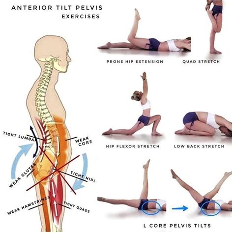 Best Exercises For Anterior Pelvic Tilt Exercise