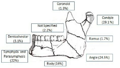Classification Of Mandibular Fracture Images And Photos Finder