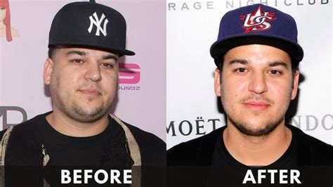 rob kardashian weight loss before and after [2024]