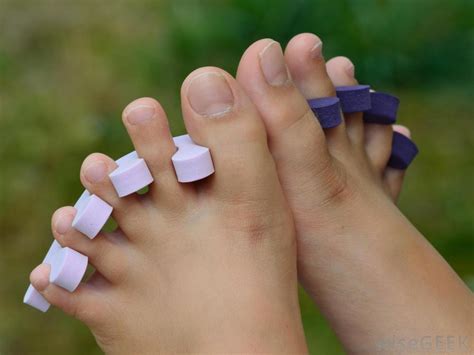 How Do I Choose The Best Hammer Toe Treatment With Pictures