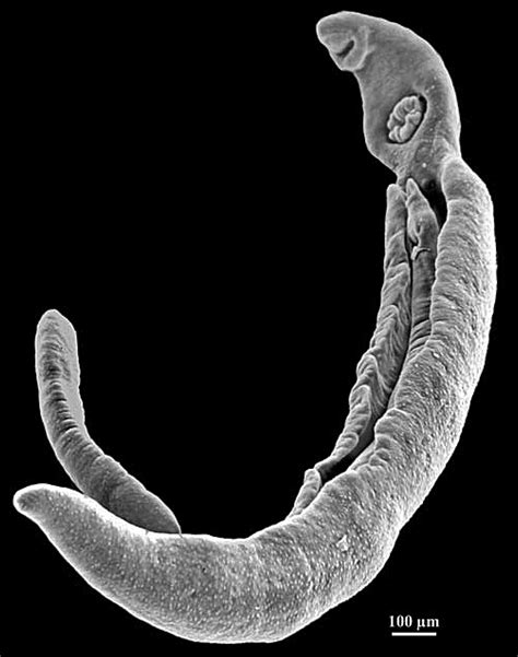 Schistosomiasis Schistosoma Parasite Smithsonian Institution