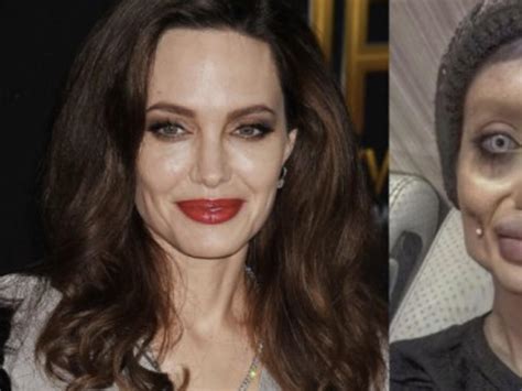 Woman Claims She Underwent 50 Plastic Surgeries To Look Like Angelina Jolie
